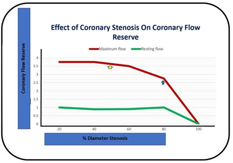 Figure The Effect Of Coronary Artery Statpearls Ncbi Bookshelf