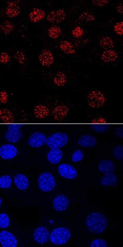 Humanmouse Myf 5 Antibody R D Systems 100ug Unlabeledantibodies