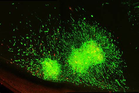 Confocal Microscopy Core Slu Saint Louis University