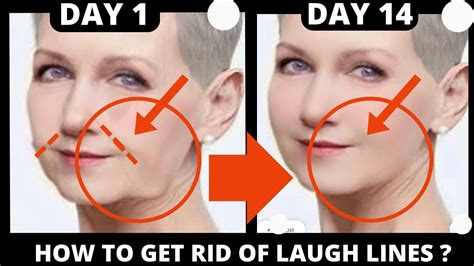 Effective Face Exercises For Laugh Lines Nasolabial Folds Saggy Skin