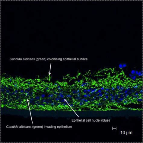 Candida Albicans Biofilm Formation On Oral Mucosal Surfaces Arrows Download Scientific Diagram