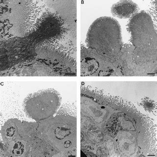 Tem Shown Are Rabbit Peyer S Patches Infected With Bs A And B