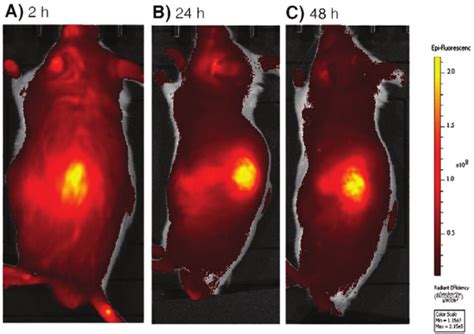 Tumor Imaging With Indocyanine Green ICG ICG Was Injected