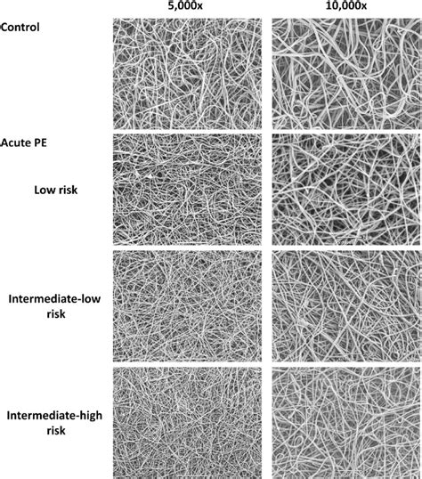 Representative Scanning Electron Micrographs Showing Morphology Of Download Scientific Diagram