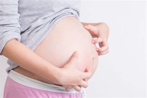 Puppp Pregnancy Rash Causes And Treatment