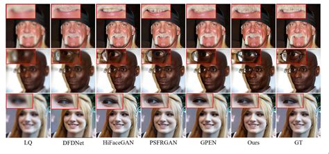 Figure 2 From Blind Face Restoration Via Multi Prior Collaboration And