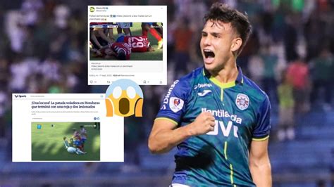 Prensa Internacional Viraliza La Brutal Entrada De André Orellana