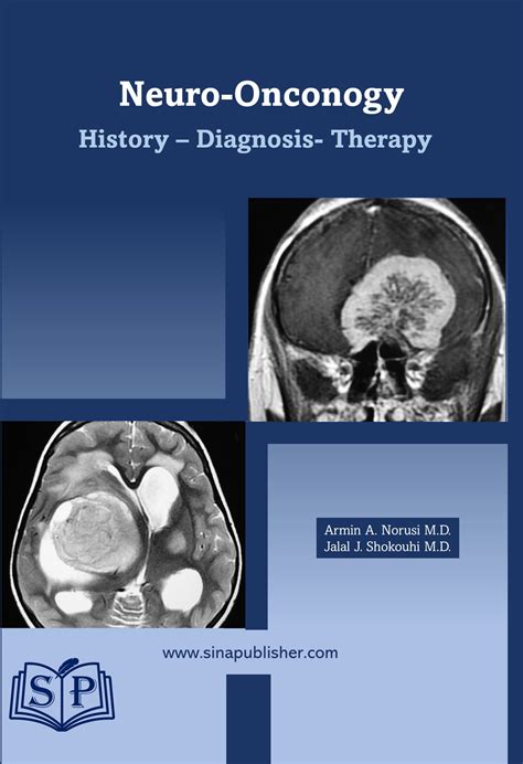 Neuro-Oncology History, Diagnostic, Therapy – Sinapublisher