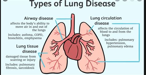 What is Lung diseases? - MEDICINE FOR WORLD