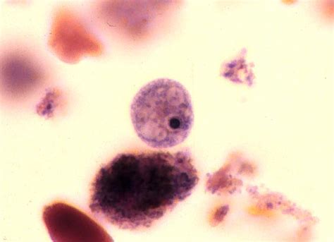 Trophozoite Trichrome Stain Department Of Parasitology Faculty Of Medicine Chiangmai University