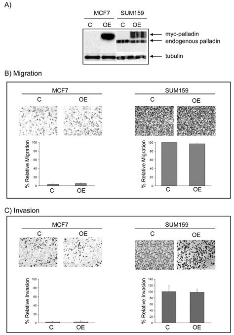 Palladin Overexpression Does Not Affect Cell Migration Of Either