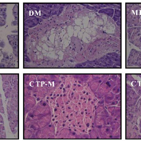 HE Staining Showing The Histopathological Changes Of The Pancreas In