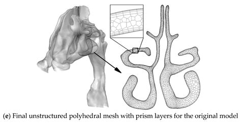 Healthcare Free Full Text Septoplasty Effect On The Enhancement Of