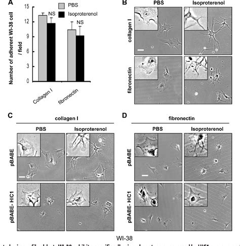 Figure 2 From Loss Of Hypermethylated In Cancer 1 HIC1 In Breast