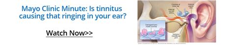 News And Articles Tackling Tinnitus