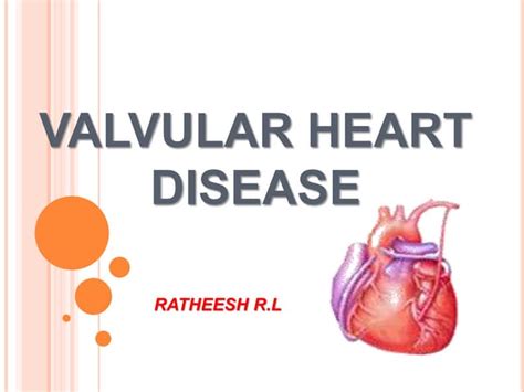 Valvular Heart Disease Ppt