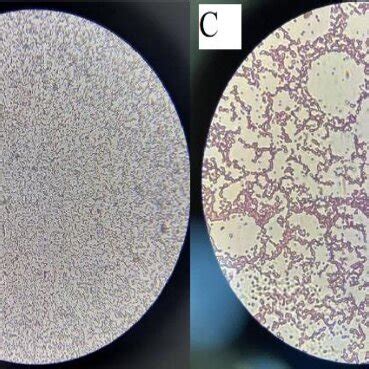 Show microorganisms under a microscope. A: S.epidermids , B ...