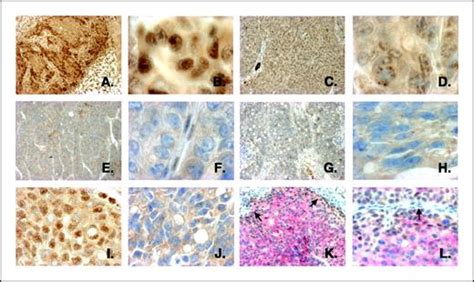 Expression And Nuclear Location Of The Transcriptional Repressor Kaiso