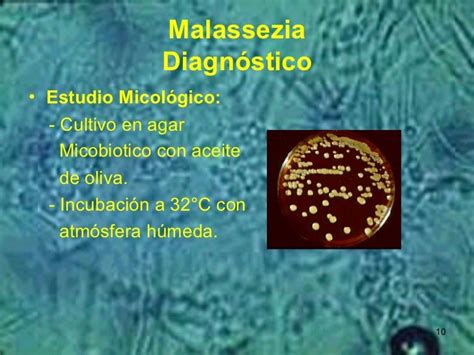 Malassezia