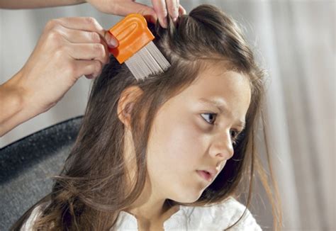 No Panic Guide To Head Lice Treatment Johns Hopkins Medicine