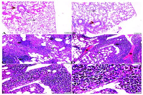 Photomicrograph Of Hande Stained Lung Tissue Sections From Mice In The