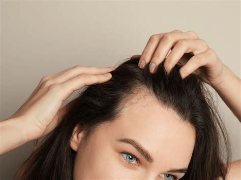 Postpartum Hair Loss Causes And How To Find Relief