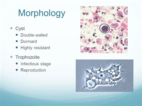 Acanthamoeba Cyst Morphology