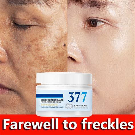 Dark Spot Remover Face Whitening Cream Freckles Removal Cream G