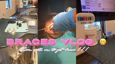 Mini Braces Vlog Come With Me To Get Braces Youtube