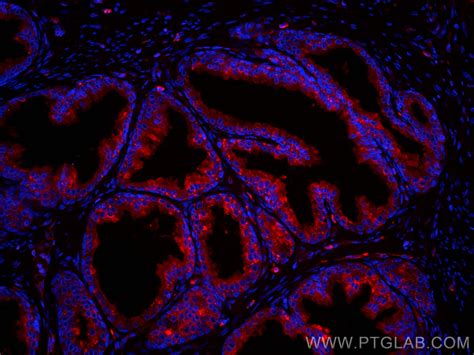 Beta 2 Microglobulin Antibody Cl594 66207 Proteintech