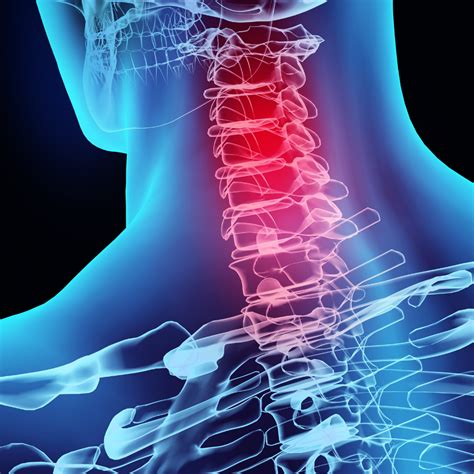 Chiropractic Treatments For Whiplash Pain Dubai Uae — Plato Health Clinic