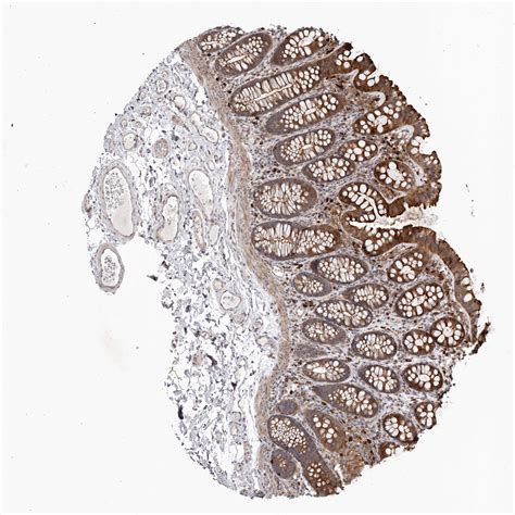 Tissue Expression Of Fgfr4 Staining In Colon The Human Protein Atlas