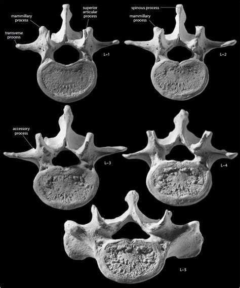 Lumbar Vertebrae Mammillary Process