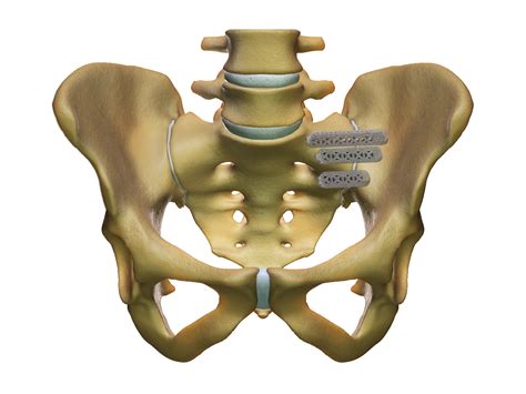 Si Joint Surgery The Ifuse Implant System Si Bone