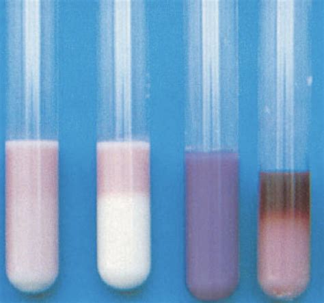 Litmus Milk Test Principle Procedure Uses And 54 Off