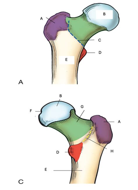 Anatomy proximal femur labeling Diagram | Quizlet