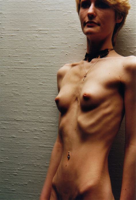 Anorexic Nude Hot Sex Picture