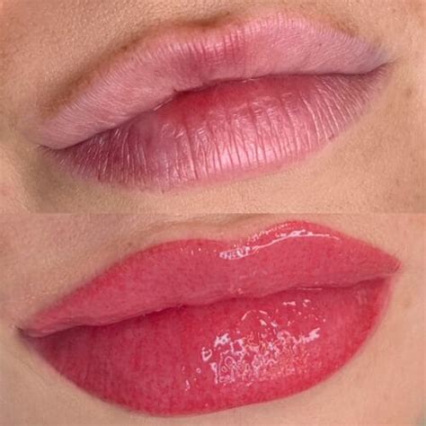 Lip Blush Tattoo Vs Lip Fillers Choosing The Perfect Look For You Daela