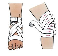 Правила наложения бинтовых повязок - ГАЛТЕЯФАРМ