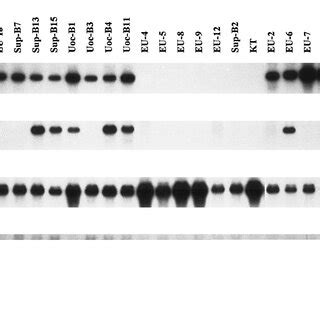 Northern Blot Analysis Of P53 Bcl 2 Bcl Xl And Bax MRNA From 22 ALL