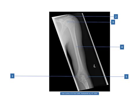 Xray Of Humerus Diagram Quizlet