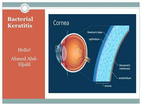 Bacterial Keratitis Ppt