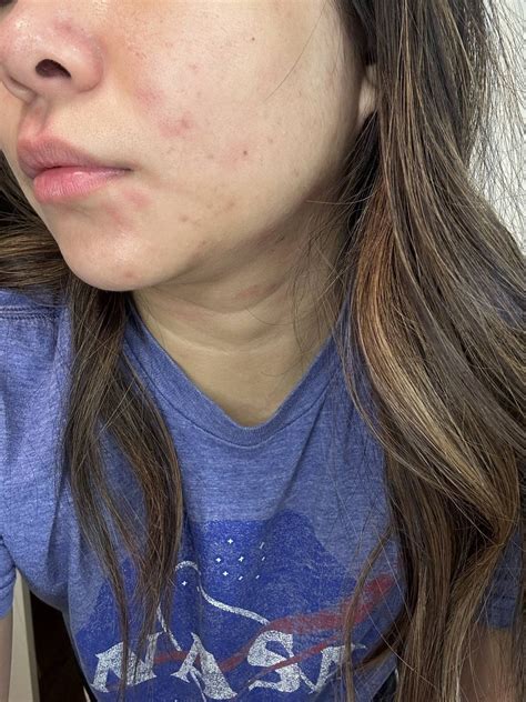 [routine Help] Does This Happen To Anyone Else My Skin Will Some Days