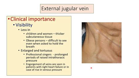 External Jugular Vein Anatomy Youtube