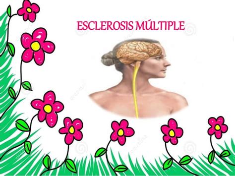 Esclerosis Multiple Ppt Descarga Gratuita