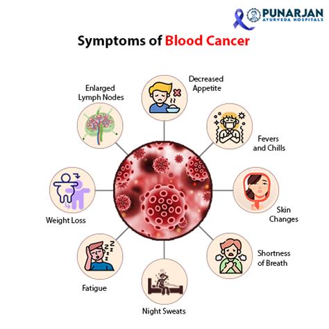 Blood Cancer Treatments Causes Symptoms Nhcancerclinics