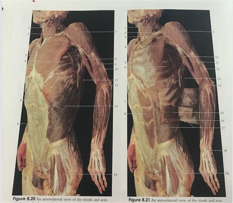 upper limb muscles Diagram | Quizlet