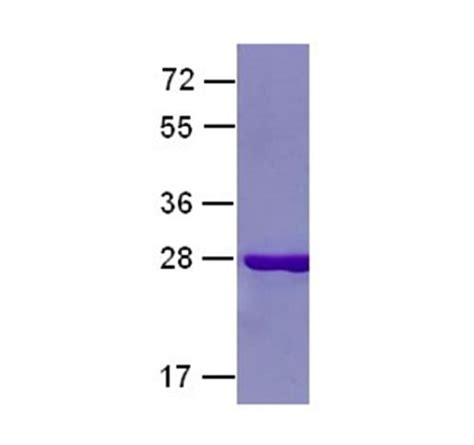 Rab7 Q67L Protein NewEast Biosciences GTPase Oncogene And