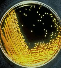 Vibrio Cholerae