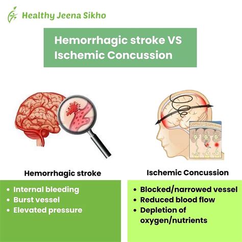 Brain Hemorrhage - Causes, Symptoms, Treatment